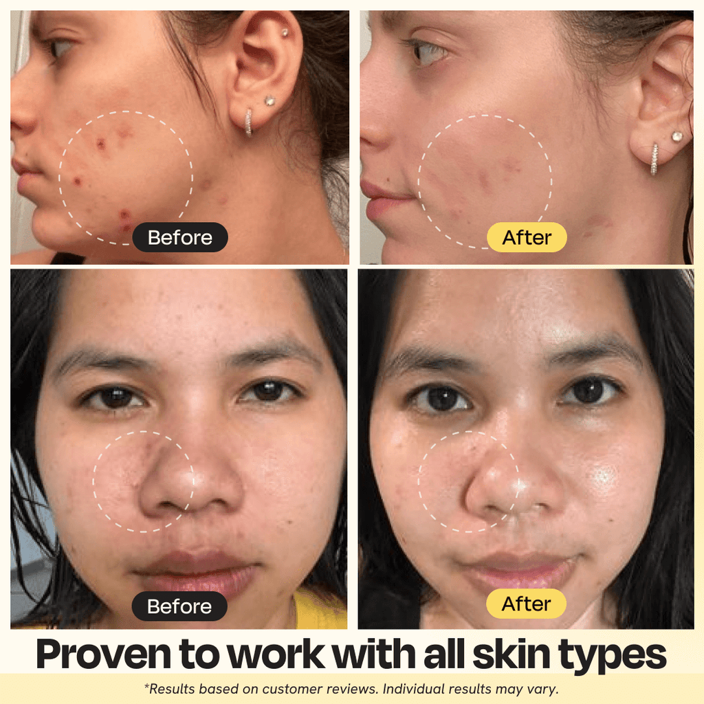 Dark Salmon Vitamin C Clay Mask